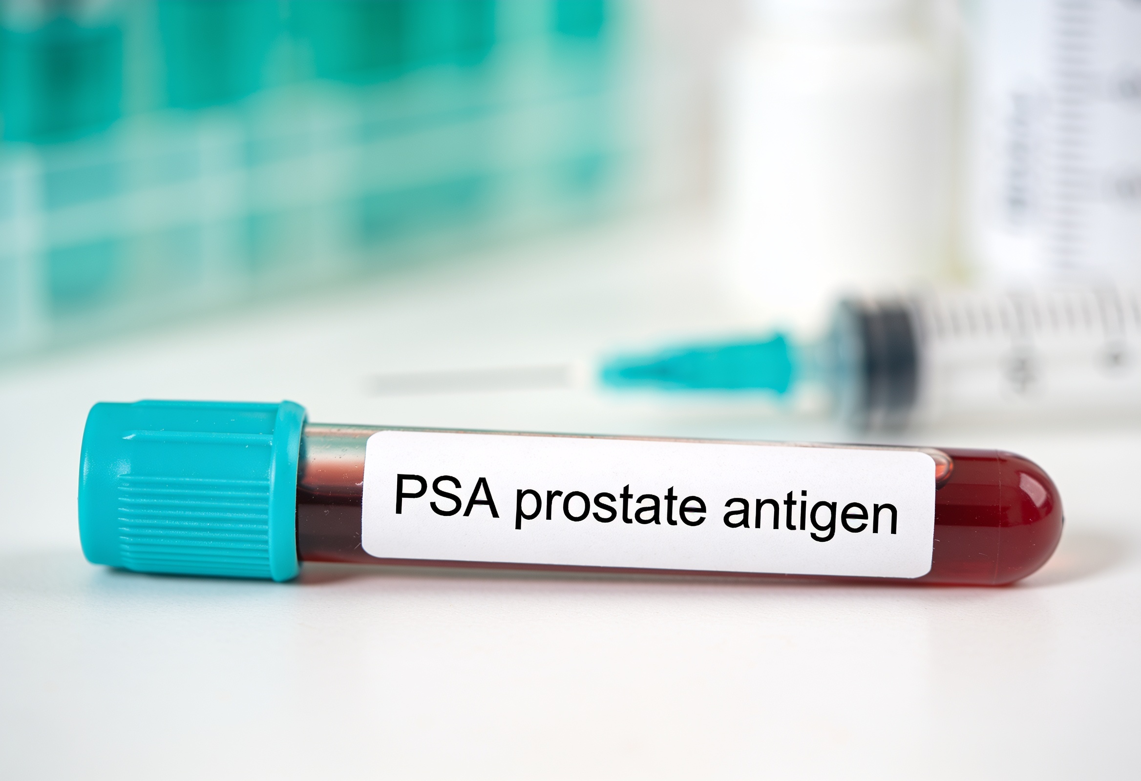 Por qué se eleva el antígeno prostático (PSA)